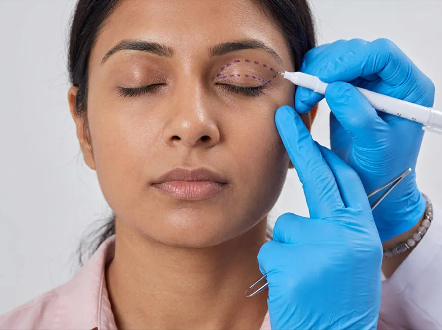 Eyelid Surgery
